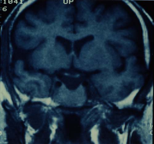 fig. 15b