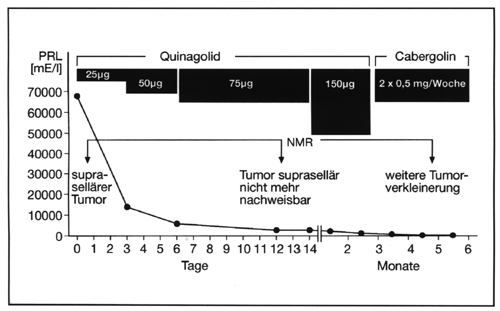 fig. 16
