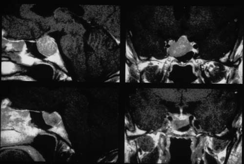 fig. 17